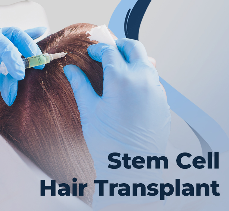 Stem Cell Hair Transplantation
